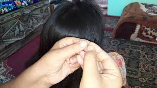 Head lice removal from hair getting out all hundred lice from head [upl. by Ysus417]