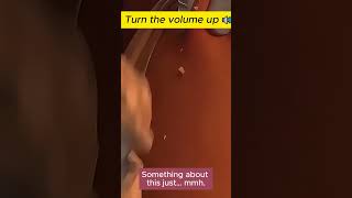 pimple popping 2024 new blackheads on nose pimple popping tiktok 35332 [upl. by Sol505]