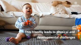 Down Syndrome Explained in a Minute  Child with Down Syndrome [upl. by Madison]