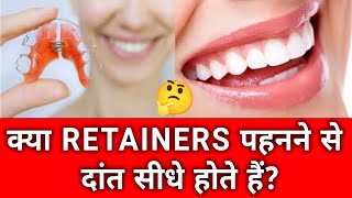 Do Retainers Straighten Teeths  क्या रिटेनर्स पहनने से दांत सीधे होते हैं [upl. by Polak266]