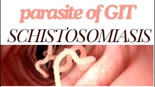 Parasitology Schistosomiasis 🪱part1 [upl. by Ssyla]