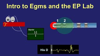 Echogenic Focus in Heart on Ultrasound What to do  Dr Sahil Chuadhry [upl. by Eiten]