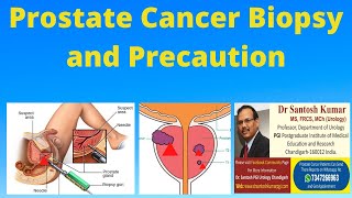 BIOPSY for PROSTATE CANCER Diagnosis  DrProfSantosh Kumar PGI [upl. by Ynnol]