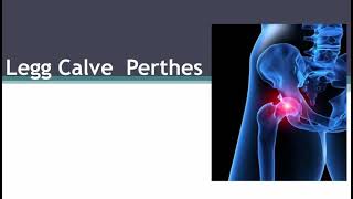 Calve Legg Perthes syndrome – what is it [upl. by Atkinson522]