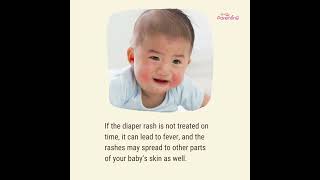 How to Spot and Treat Diaper Rash [upl. by Dov]