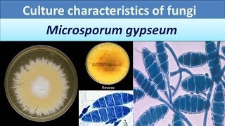 Microsporum gypseumClear over view about Colony morphology [upl. by Earleen]