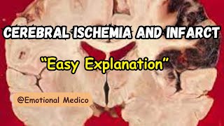 Cerebral ischemia and infarct  Review  CNS pathology  emotionalmedico [upl. by Nydia]