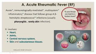 CVS Pathology Rheumatic and infective endocarditis lectureالحمى الروماتيزمية [upl. by Nomelif869]