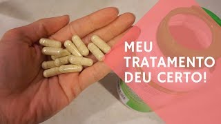 Como ACABEI com a minha Sindrome do Intestino Irritavel  Tratamento NATURAL [upl. by Fredek]