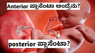 ಗರ್ಭಿಣಿಯರಲ್ಲಿ ANTERIOR POSTERIOR ಪ್ಲಾಸೆಂಟಾ ಅಂದ್ರೇನು kannada pregnancy [upl. by Azil]