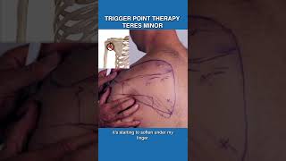 Releasing Teres Minor Trigger Points [upl. by Ssitnerp]