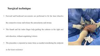 Arthroscopy With Adipose Derived Stromal Vascular Fraction Using a Selective Tissue Engineering Phot [upl. by Lucius]