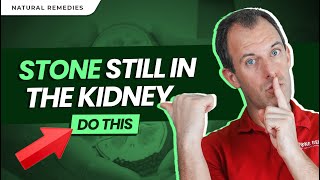 Stone Still in the Kidney Do this [upl. by Adnoryt614]