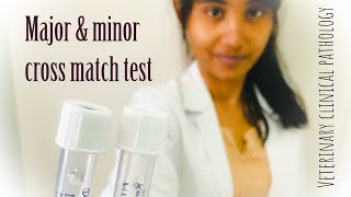 Cross match test major and minor [upl. by Chrystal]