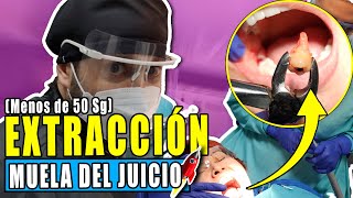 Video en 🔴VIVO Extracción de 𝗠𝗨𝗘𝗟𝗔 𝗗𝗘𝗟 𝗝𝗨𝗜𝗖𝗜𝗢 sin cirugia 𝐈𝐍𝐂𝐑𝐄𝐈𝐁𝐋𝐄 en SOLO 🚀50SG y SIN DOLOR [upl. by Sinaj266]