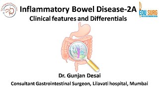 Inflammatory bowel disease  Ulcerative colitis and Crohns disease  Clinical Features Part 1 [upl. by Coben]