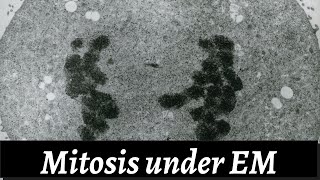 Mitosis Under Electron Microscope [upl. by Nivrad]