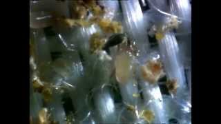 Close Up of House Dust Mites [upl. by Meadow]