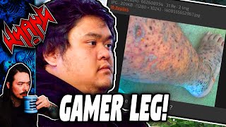 Gamer Leg  Tales From the Internet [upl. by Quick]