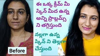 Royalstar Derma15 Skin Specialist Cream Telugu ఈ ఒక్క క్రీమ్ నల్లగా ఉన్న స్కిన్ ని తెల్లగా చేస్తుంది [upl. by Baudin]