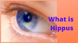 What is Hippus [upl. by Eelime260]