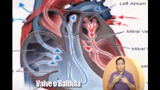 Sagot ni Dok  Rheumatic Heart Disease [upl. by Worrad86]