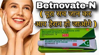 Betnovate N skin cream  Betamethasone Neomycin cream  Betnovate N cream [upl. by Yasdnyl]