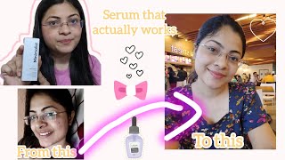 How i cleared my dark spots and pigmentation✨🤔Alpha arbutin review☺️ [upl. by Dincolo]