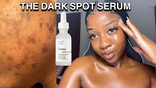 HOW TO GET RID OF DARK SPOTS WITH ONE PRODUCT  The ordinary [upl. by Augustus]