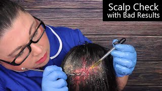 ASMR Scalp Check with Bad Results Dandruff Removal Scalp Treatment Whispering Medical Roleplay [upl. by Akemahc733]