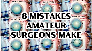 8 Mistakes new surgeons make  Part 1  Blunders in sideports and main ports [upl. by Alithea202]