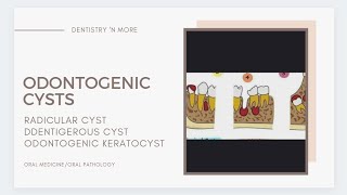 ODONTOGENIC CYSTS [upl. by Henri]