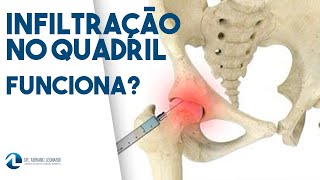 BURSITE DO QUADRIL Infiltração funciona [upl. by Omrelliug]