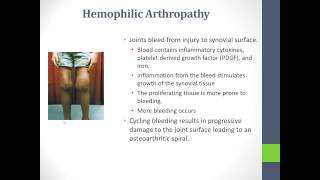 Basics of Hemophilia [upl. by Artamas]