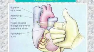 34 Transverse sinus of pericardium [upl. by Davies235]