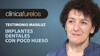 Mari Luz Implantes dentales con poco hueso [upl. by Maddocks]