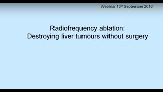 ETHealthworld Webinar  Radiofrequency Ablation Destroying Liver Cancer without Surgery [upl. by Elda]