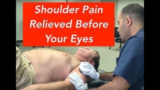 Chronic Shoulder Pain Relieved in Minutes With ASTR SAFE REAL RELIEF [upl. by Aiza339]