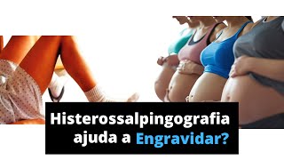 Histerossalpingografia ajuda a Engravidar [upl. by Arbed]