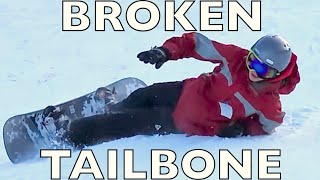 BROKEN TAILBONE SNOWBOARDING [upl. by Emee]