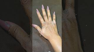 Chemical Peel On knees And Hands clearstemskincare ytshorts sristydutta [upl. by Philippe]