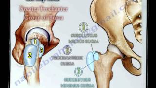 Bursitis Around The Hip  Everything You Need To Know  Dr Nabil Ebraheim [upl. by Ajet915]