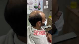 hairlossttreatment hairpatch hairloss hairwig trendingshorts taubatauba vickykaushal trend [upl. by Hershel820]