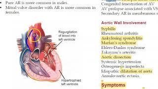 Medicine 156 Aortic Regurgitation Austin Flint Early Diastolic Murmur Water Hammer Pulse collapsing [upl. by Goodden]