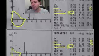 Spirometrie 5  exemple DVR disfunctie ventilatorie restrictiva [upl. by Esinyt]