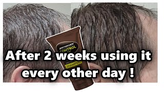 Just For Men Control GX Shampoo Full Review with Before and After Pics [upl. by Kaslik]