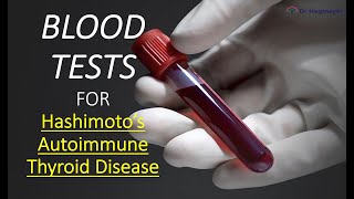 How To Test for Hashimotos Thyroid Disease How Do I Know If I Have Autoimmune Thyroid Disease [upl. by Isoais18]