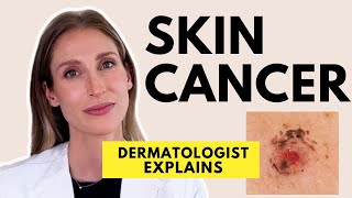 Skin Cancer Different Types Causes Prevention amp Treatments  Dr Sam Ellis [upl. by Thay377]