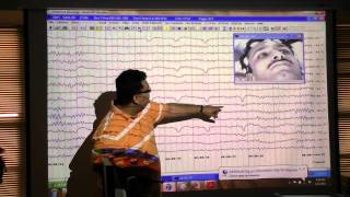 An EEG introduction [upl. by Aihsened]