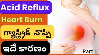 What is the Root Cause For Acid Reflux  Heart Burn  GERD  Gastric Trouble  Dr Sasapu MD [upl. by Pennington]